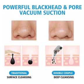 Electric Suction Blackhead Instrument Home Beauty Instrument Blackhead Pore Cleaning (rechargable)